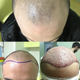 Adjuvan Hair Clinic