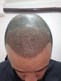 Ahenk hair center