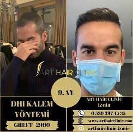 Art Hair Clinic Saç Ekim Merkezi