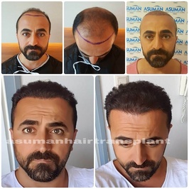 Asuman Hair
