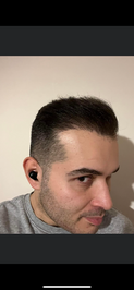 Aydın saç ekim merkezi Maxhairclinik