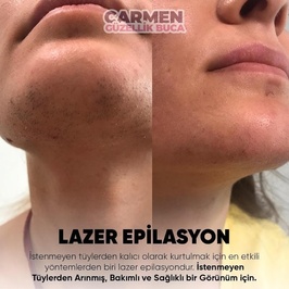 Carmen Güzellik ve Lazer Merkezi