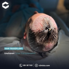 Clinista