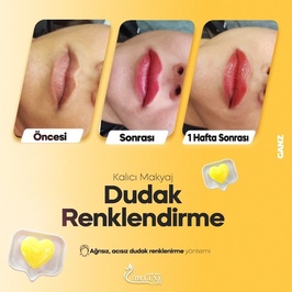 DELUXE LİFE GÜZELLİK MERKEZİ