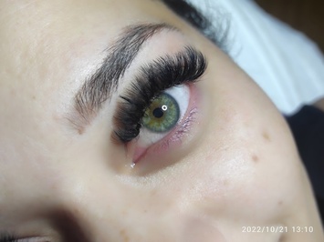 Diamond Beauty Güzellik Salonu Aydın Lazer