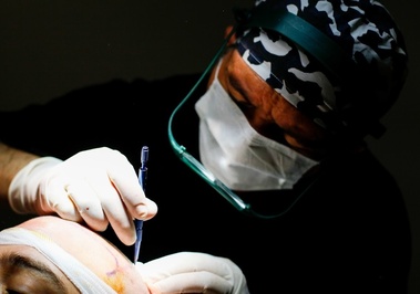 Dr. Fatih Köroğlu Hair Transplant & Trasplante Capilar