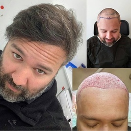drkinyashairclinic