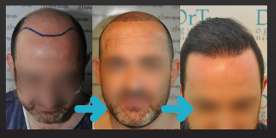 DrT Hair