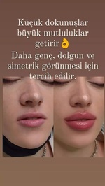 Elit Güzellik Estetik Kişisel Bakim Merkezi