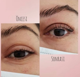 Eska Beauty Vip