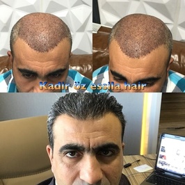 Essila Hair Center