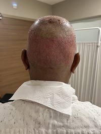 esteGrande Hair Transplant and Plastic Surgery