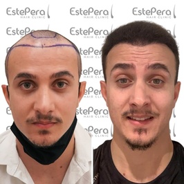 Estepera Hair Clinic