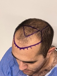 EstePro Health clinic