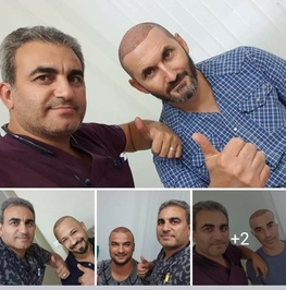 ESTETİK HAİR SAÇ EKİMİ