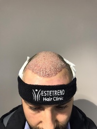 Estetrend Health Center