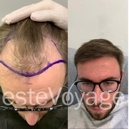 EsteVoyage