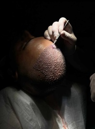Estex Clinic