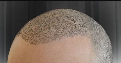 Fixhair Clinic