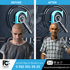 Focus Clinic İzmir