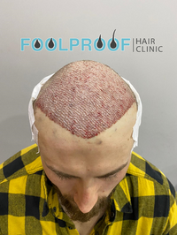 Foolproof Hair Clinic