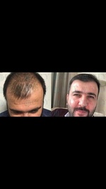 FUECITY IJLAL SAYAR HAIR CLINIC