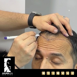 Golden Lion Hair Clinic