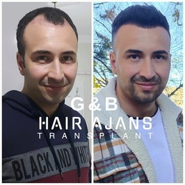 Hair Ajans Saç Ekim Merkezi