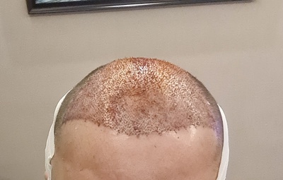 Hair Chiefs