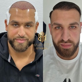 Hair City İstanbul Saç Ekim Merkezi