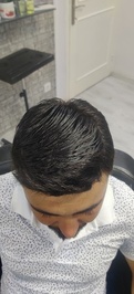 HairAndMe Protez Saç Merkezi Alsancak İzmir