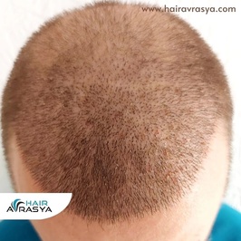 Hairavrasya
