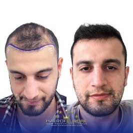 Hairofeuropa