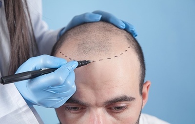 İstanbul Saç Ekim Merkezi - Mt Hair Clinic