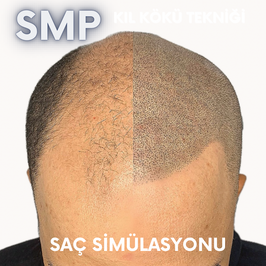 İzmit Saç Simülasyonu