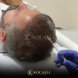 Kocaeli Saç Ekimi Merkezi