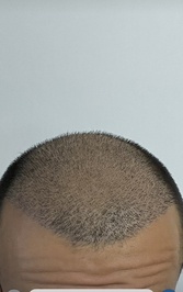 Kolan Hair