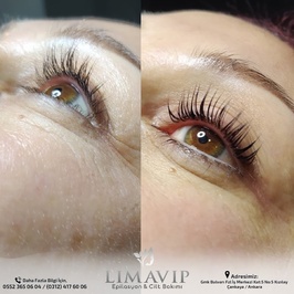 Limavip Güzellik Salonu Ankara