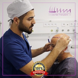 Liva Hair Transplant