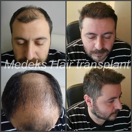 Medeks Hair Center