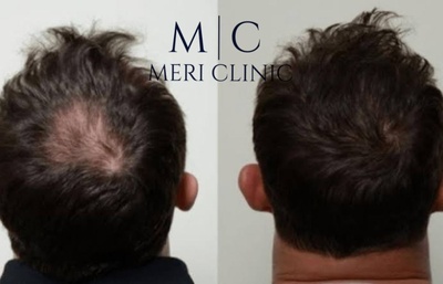 Meri Clinic