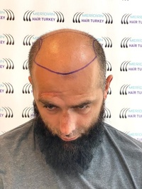 Meridian Hair Turkey