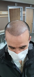 Mir Hair Clinic