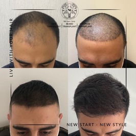 NS Hair Clinic