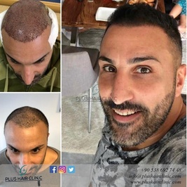 Plus Hair Clinic
