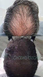 SAÇ SİMÜLASYONU UYGULAMA MERKEZİ | ÇAĞDAŞ ÖZCAN