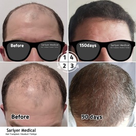 Sariyer Medical Hair Transplant Center