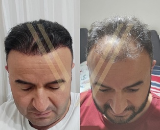 Vantage Hair Clinic