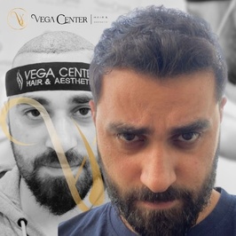 vega hair center
