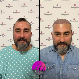 Wealth Hair Clinic